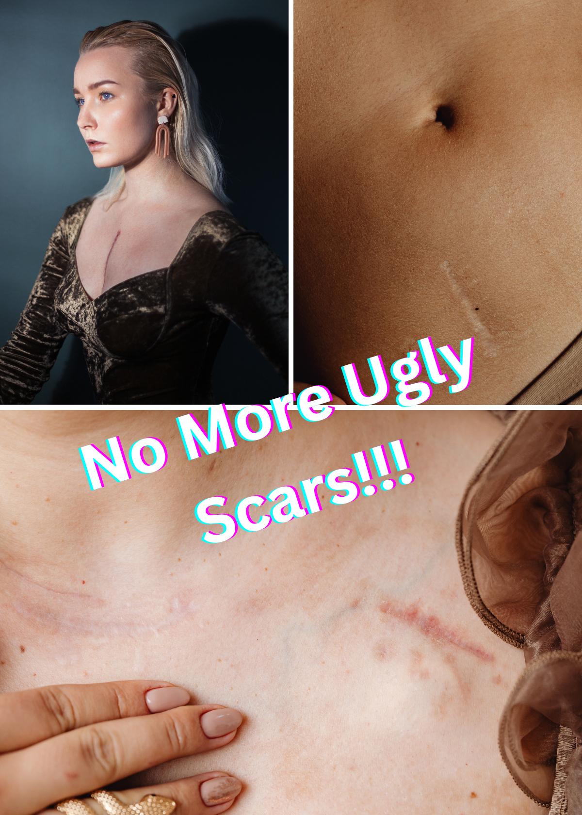 "Scar Tape: The Simple Solution to Fade Scars and Boost Your Confidence!"