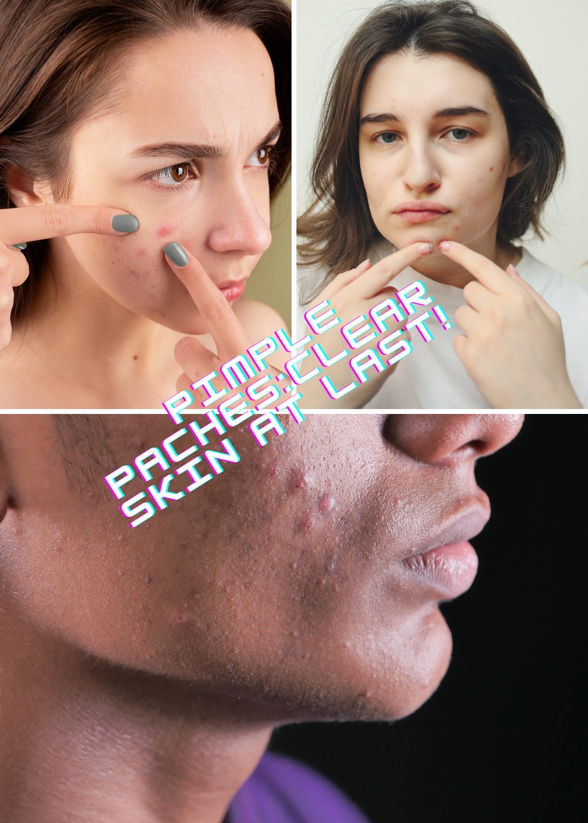 "Pimple Patches: The Ultimate Secret Weapon for Clear Skin Revealed!"